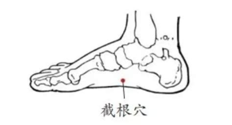 截根穴位置|截根的准确位置是什么？